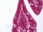 ACAT1 Antibody